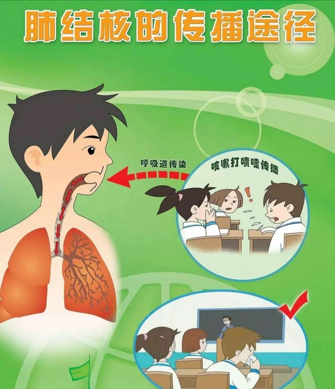 結核病2.webp.jpg